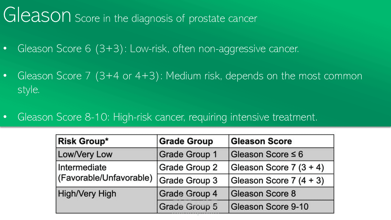 GLEASON SCORING SYSTEM Of Prostatic Cancer | مستقل