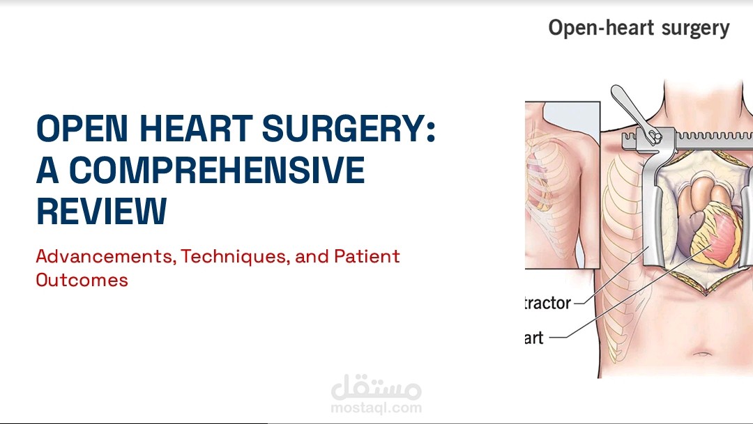 Open Heart Surgery: A Comprehensive Review of Advancements, Techniques, and Patient Outcomes