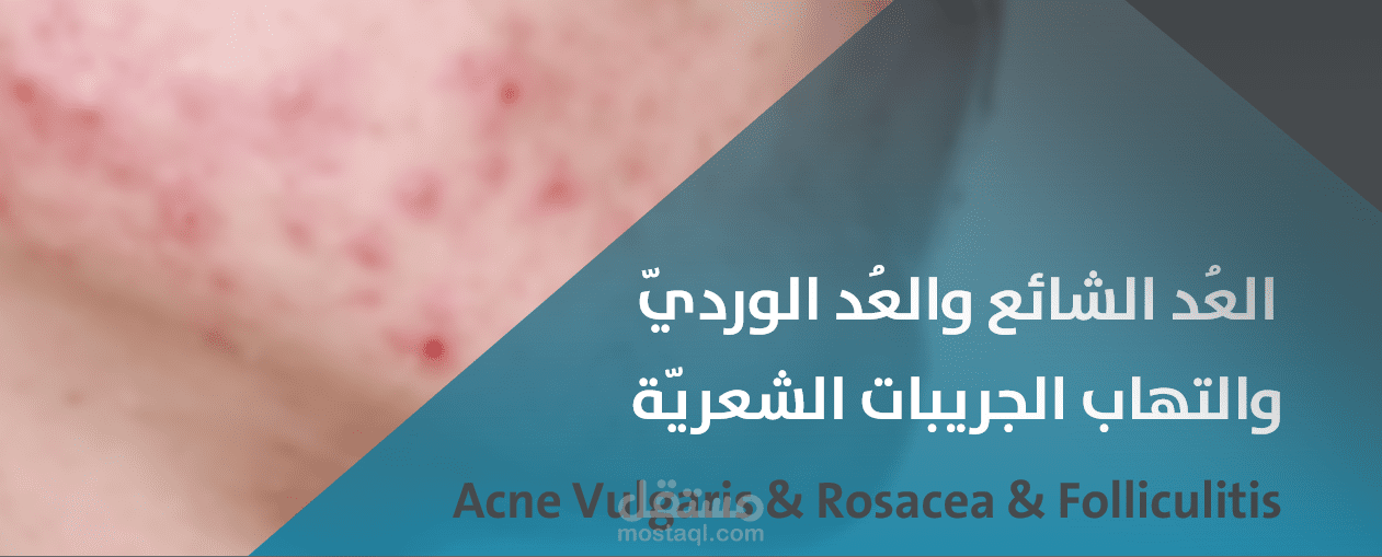 كتاب طبي مترجم حول العُد الشائع والعد الوردي والتهاب الجريبات الشعرية.