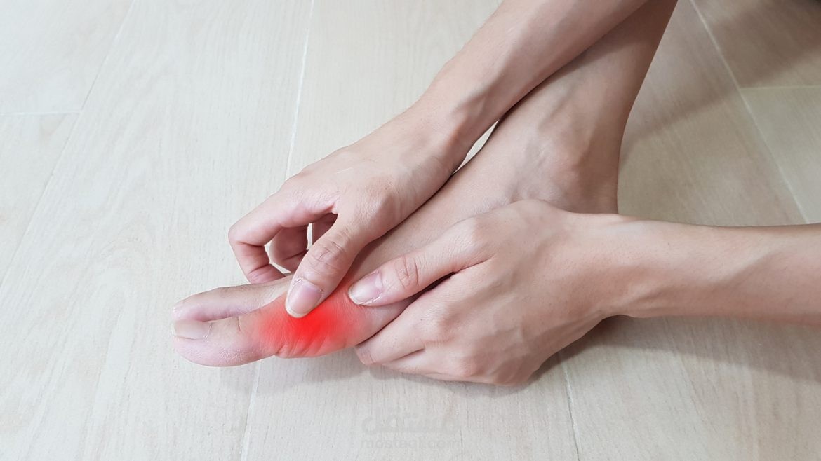 النقرس أعراضه وطرق علاجه
