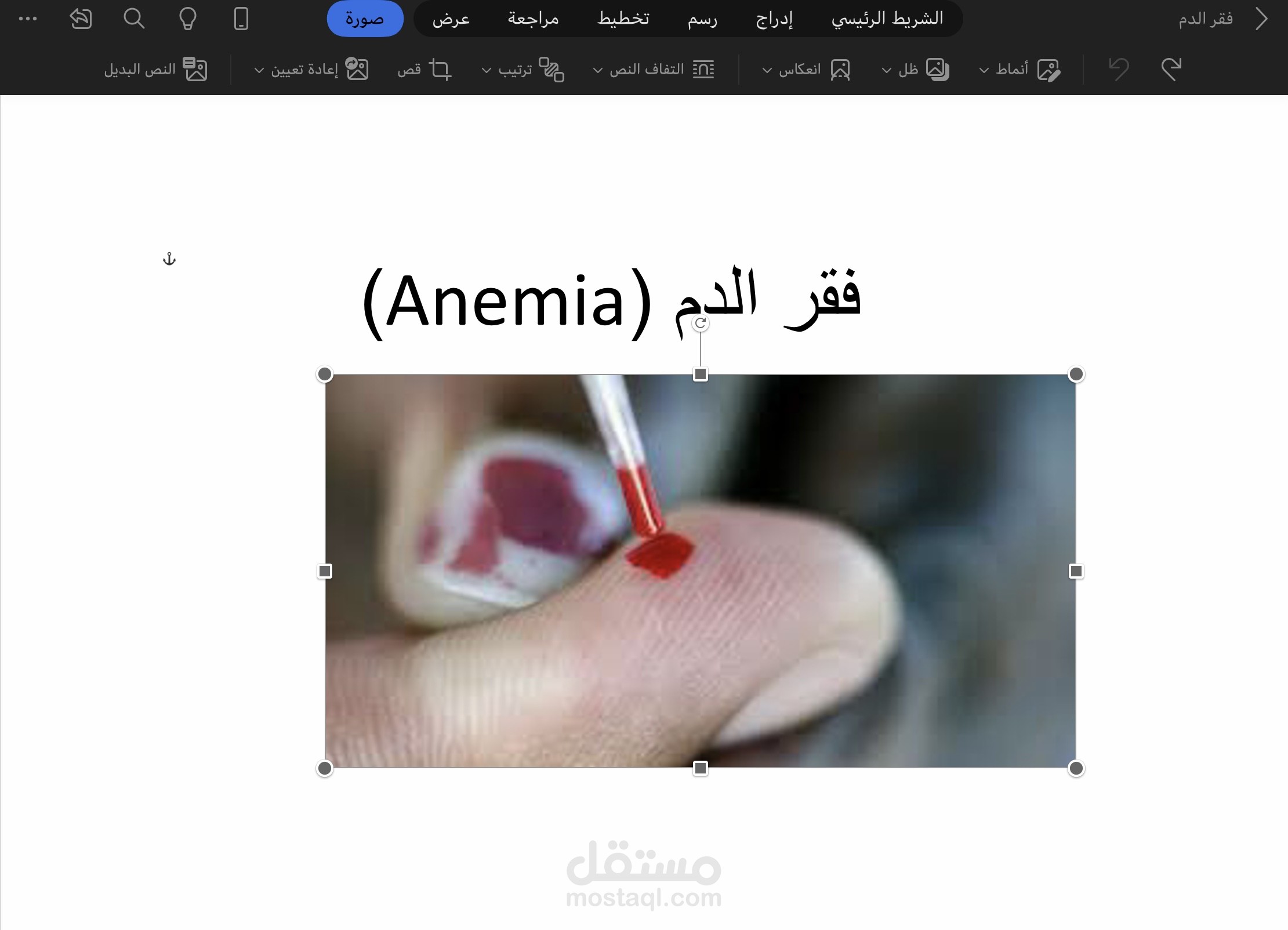 فقر الدم