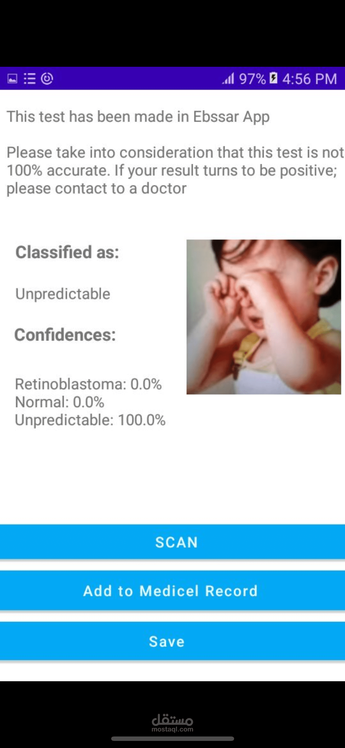 Detecting Eye Cancer Application