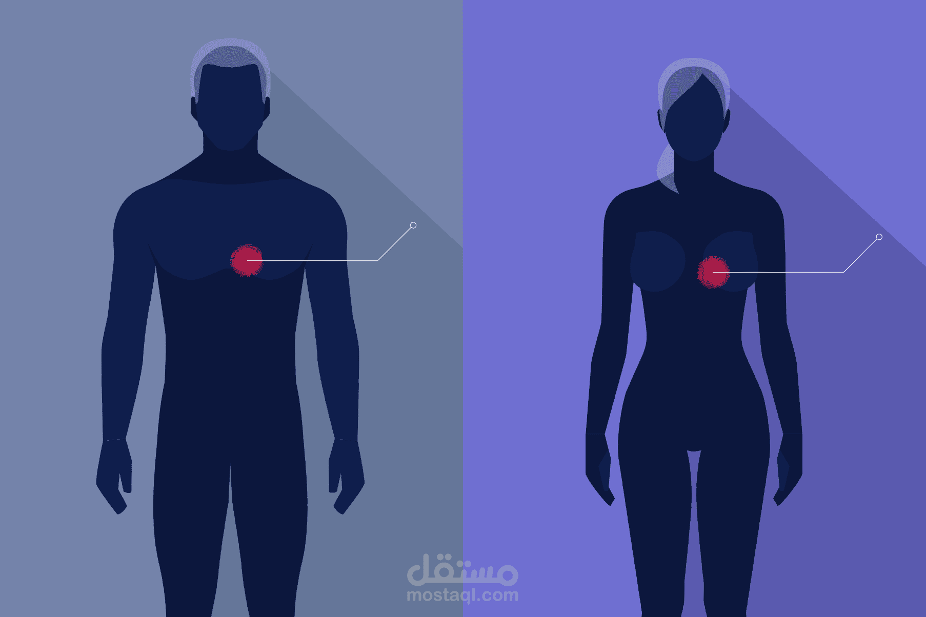 دراسة حول الفرق بين علاج النوبات القلبية عند الجنسين