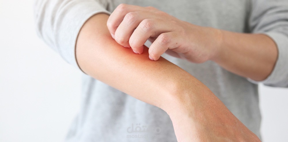 مقال حصري عن مرض التهاب النسيج الخلوي Cellulitis