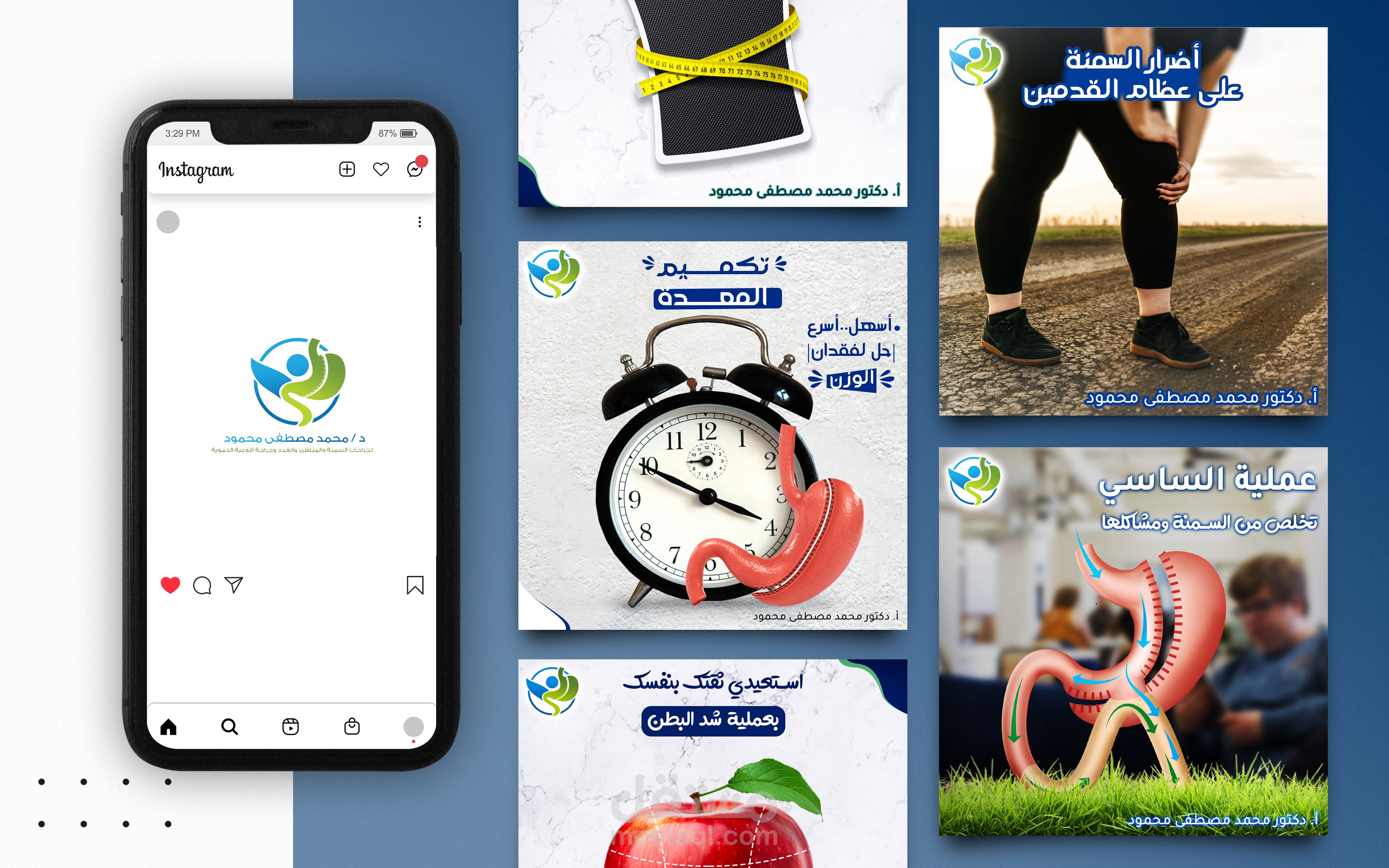 تكميم المعدة وتخسيس الوزن | تصميم سوشيا ميديا Social media design
