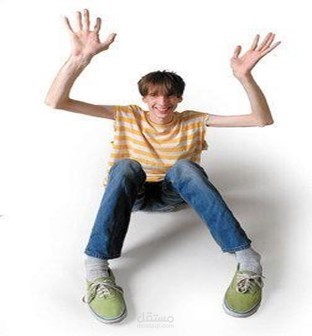 متلازمة مارفان - Marfan syndrome