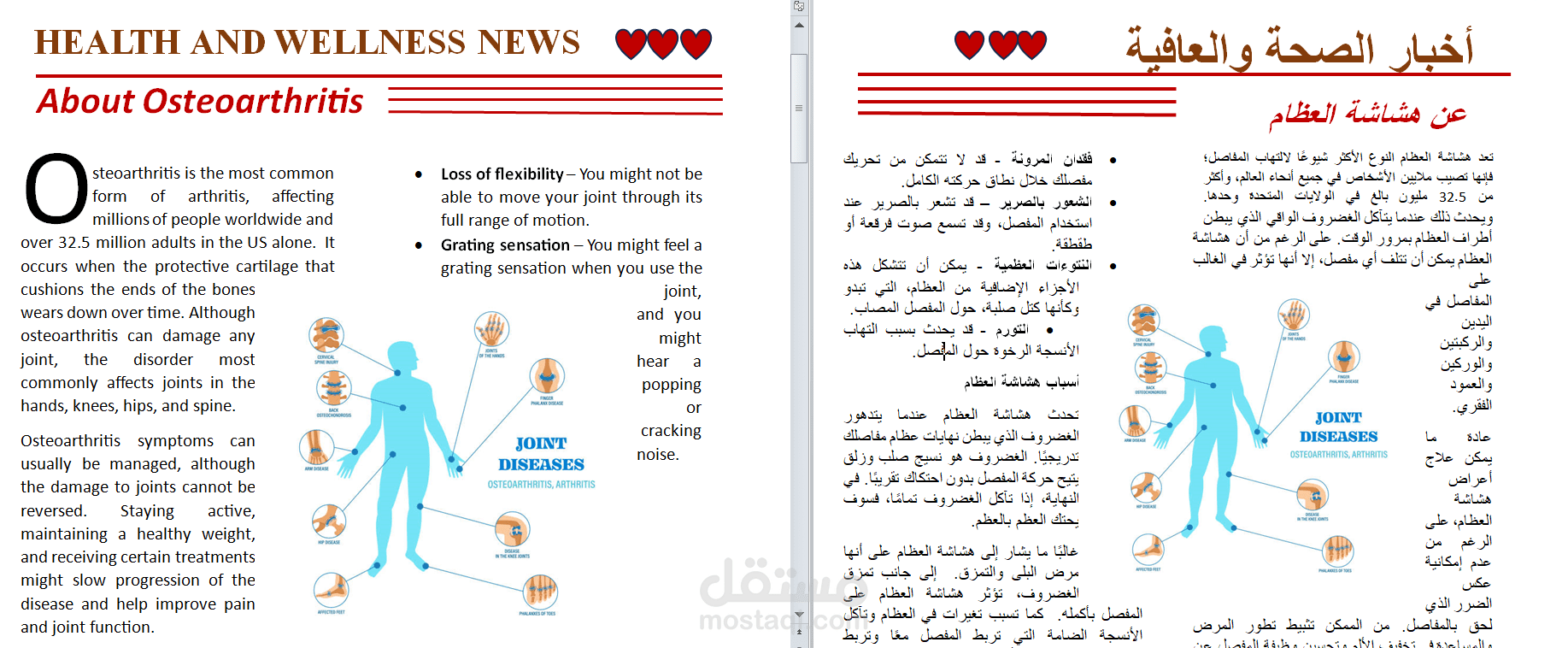 ترجمة مقالة عن هشاشة العظام