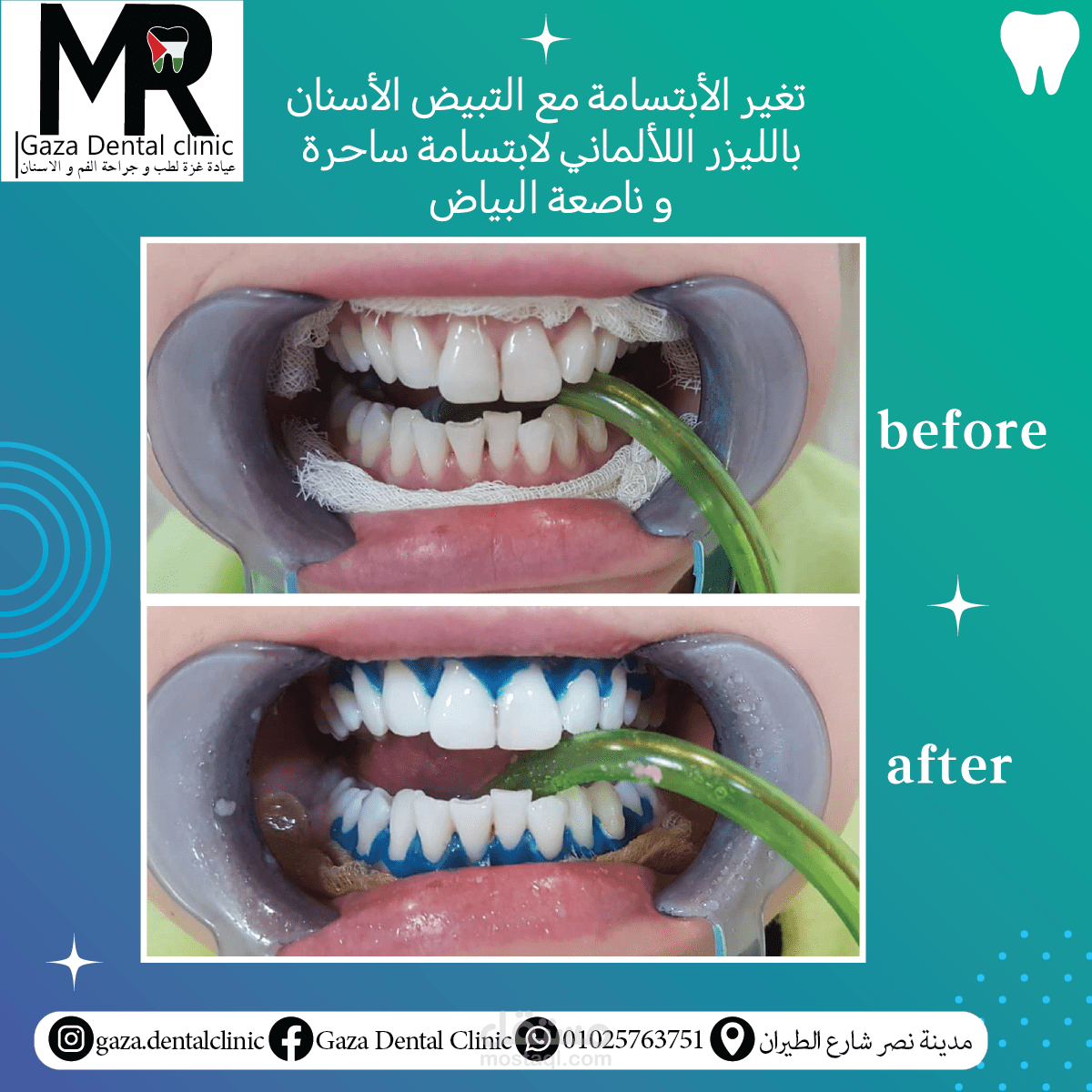 تصميم اعلان لعيادة اسنان