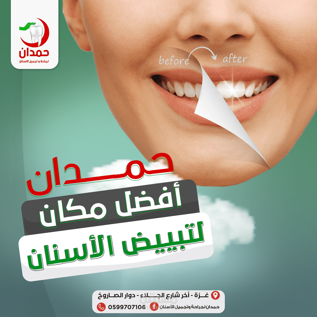 تصاميم سوشيال ميديا (عيادة أسنان)