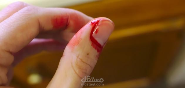 أعراض نقص الصفائح الدموية