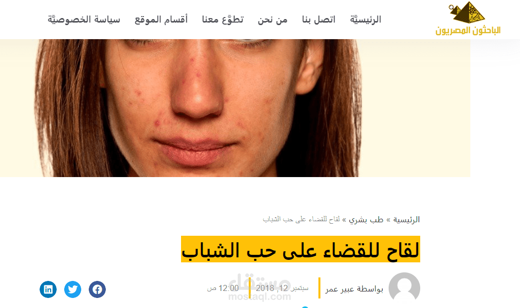 اكتشاف لقاح للقضاء على حب الشباب