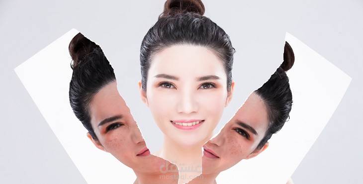 تصبغات الوجه وأهم طرق العلاج