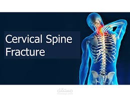 Cervical Spine Fracture تحليل بيانات