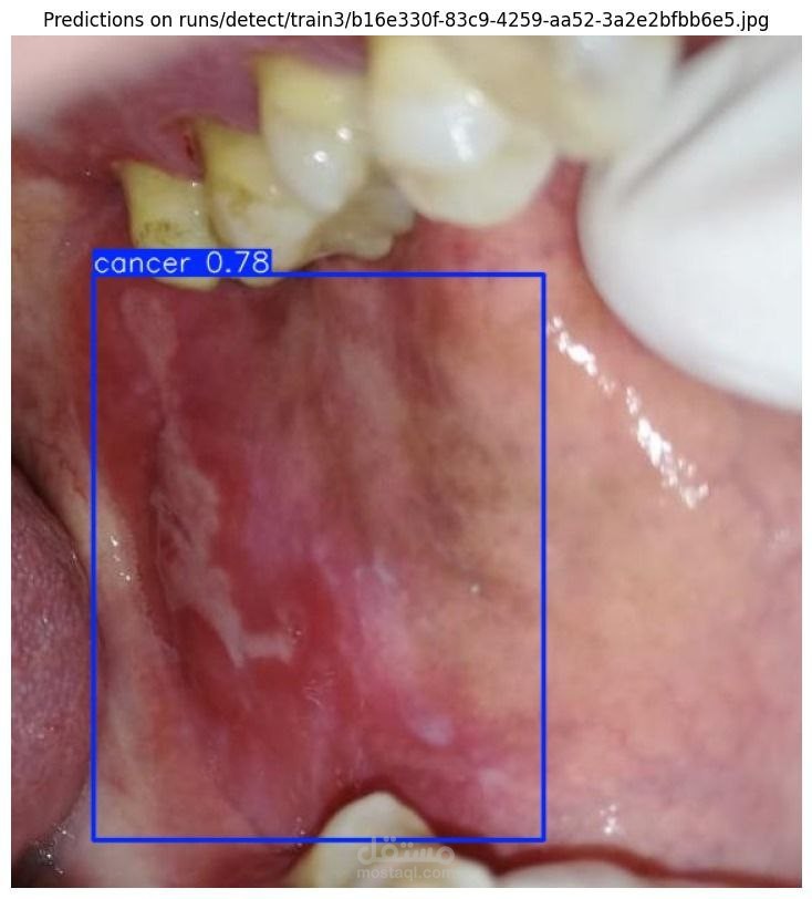 Oral Cancer Detection