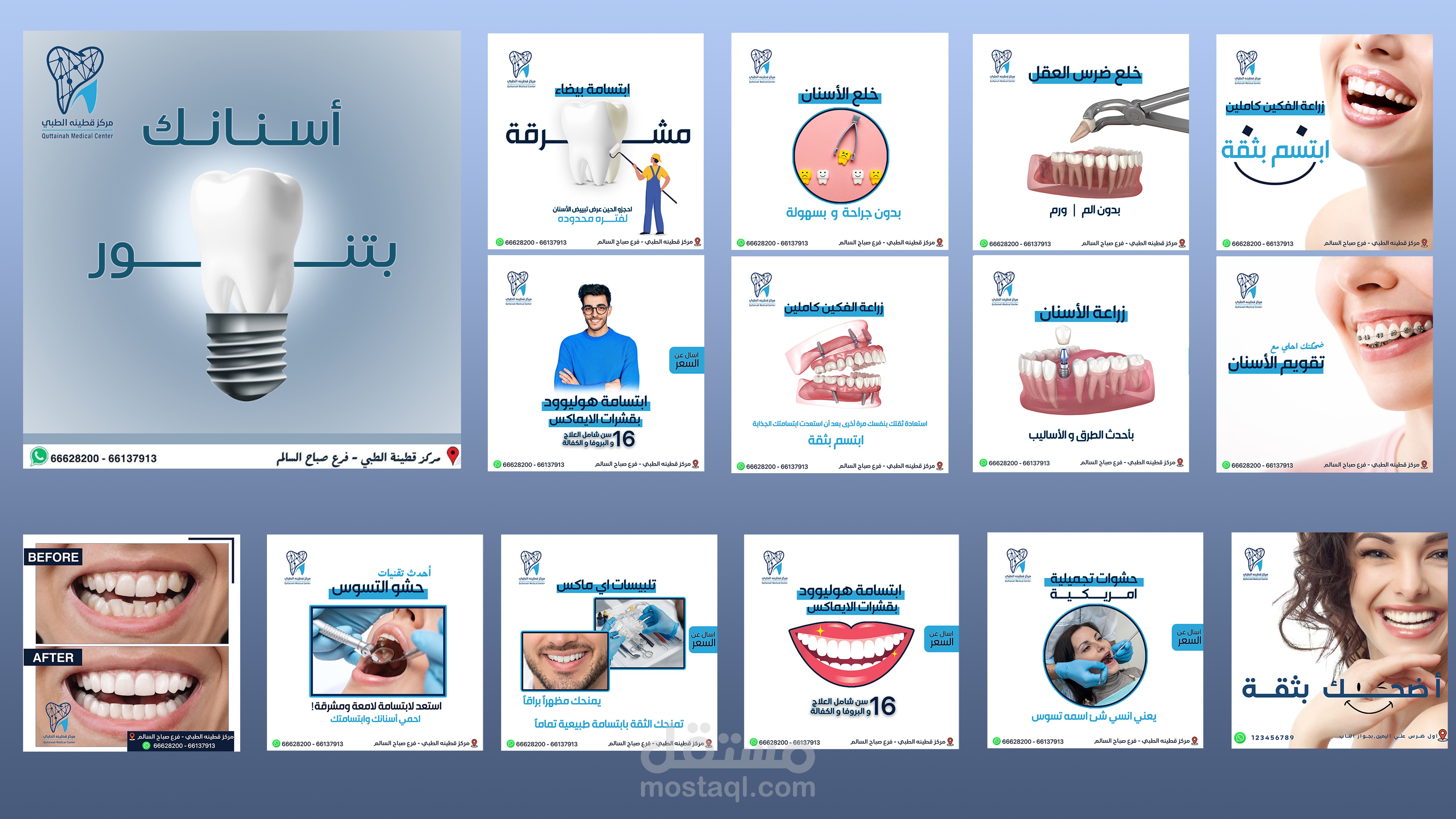 بوستات سوشيال ميديا ل عيادة اسنان