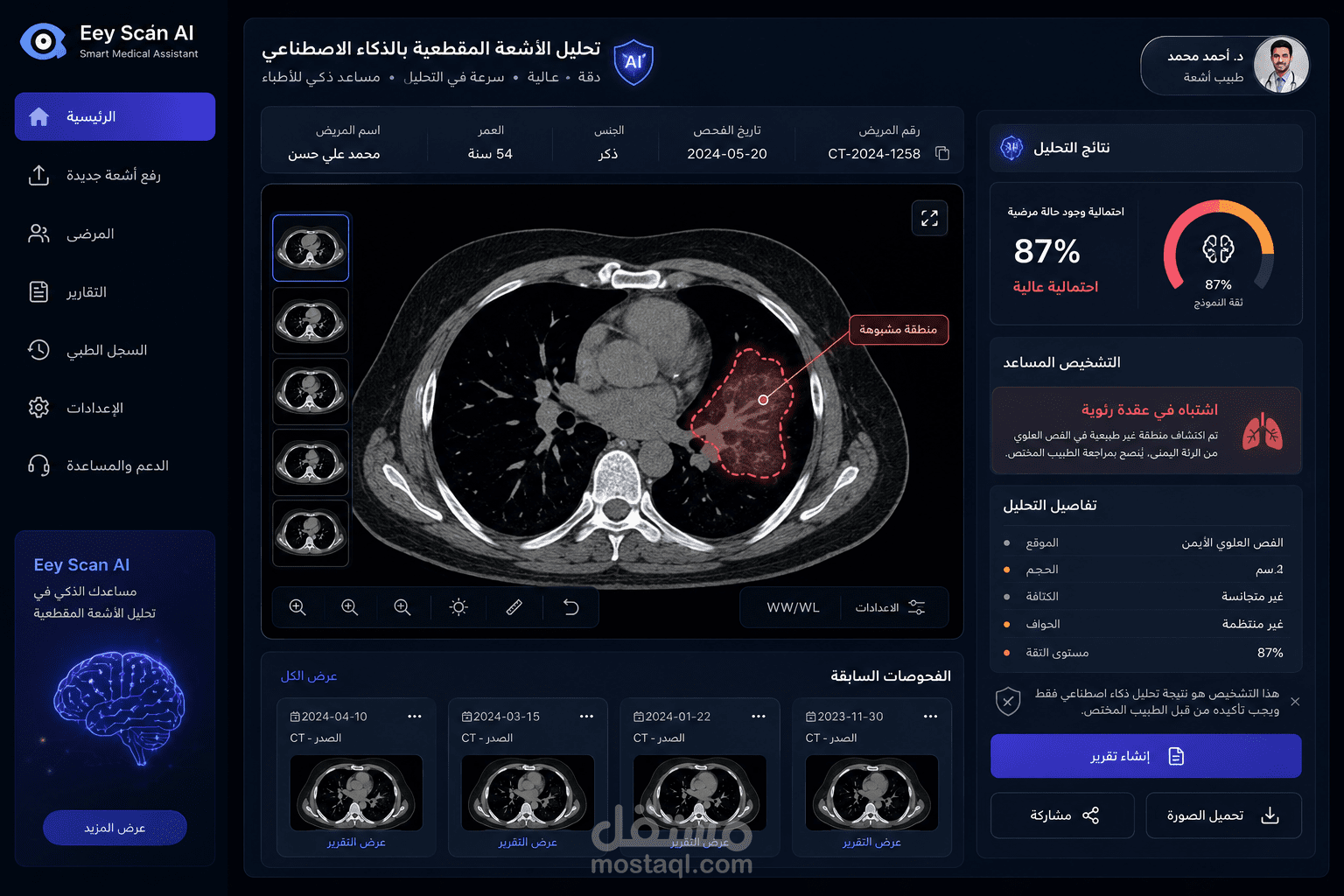 تطوير وتدريب نموذج ذكاء اصطناعي لتحليل الأشعة المقطعية وتحويله إلى تطبيق طبي ذكي – Eey Scan AI