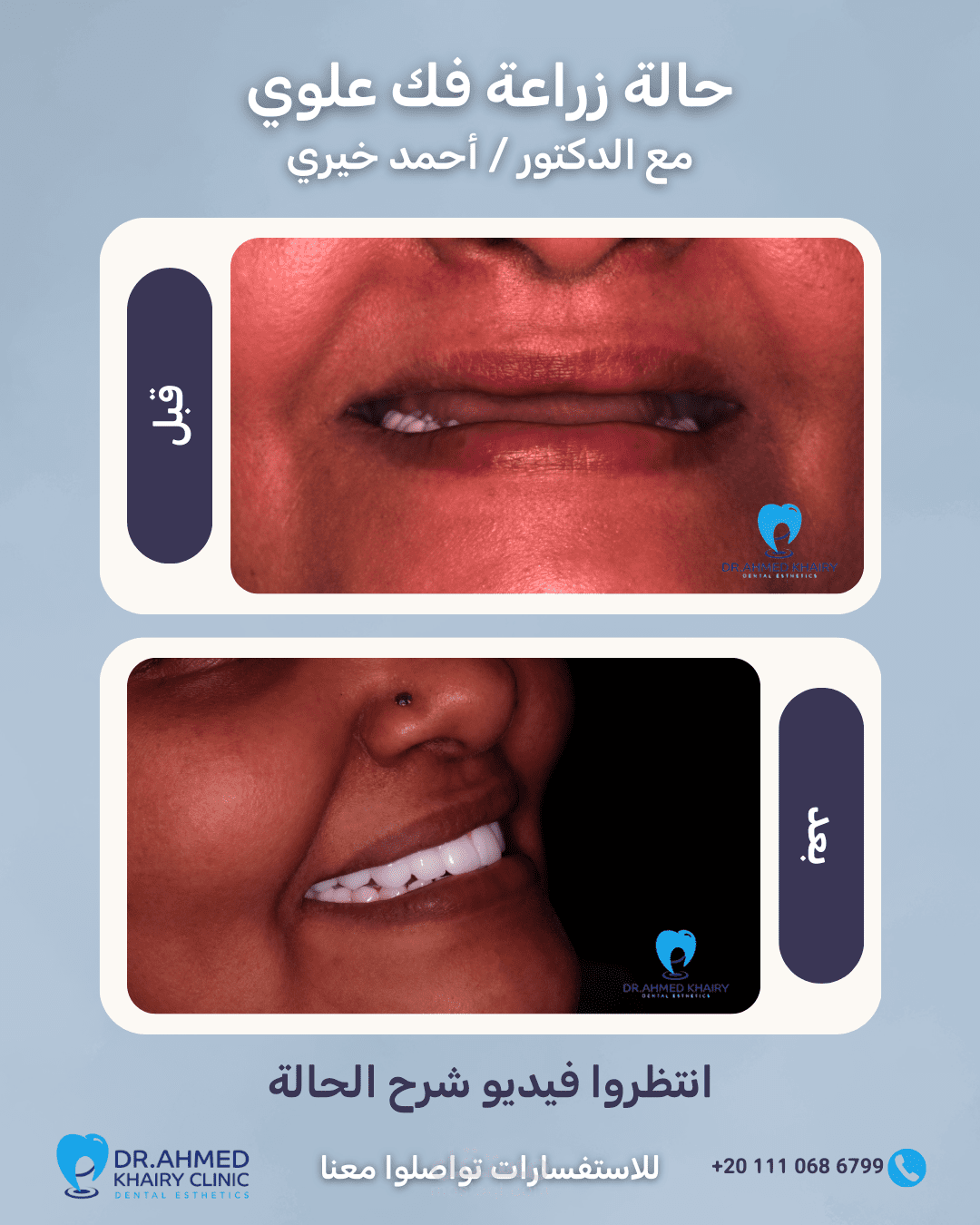 عمل تعديل لفيدوهات عيادة اسنان وعمل تصميمات لها
