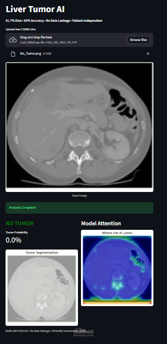 Liver Tumor AI – كشف الأورام في الكبد بالذكاء الاصطناعي