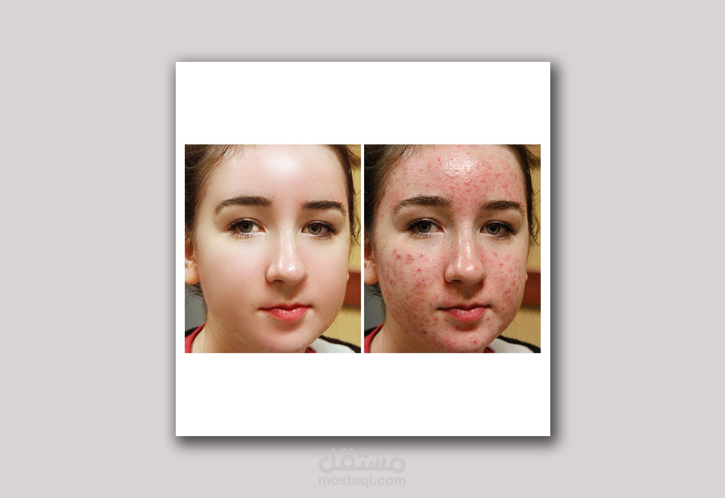 التعديل على الصور