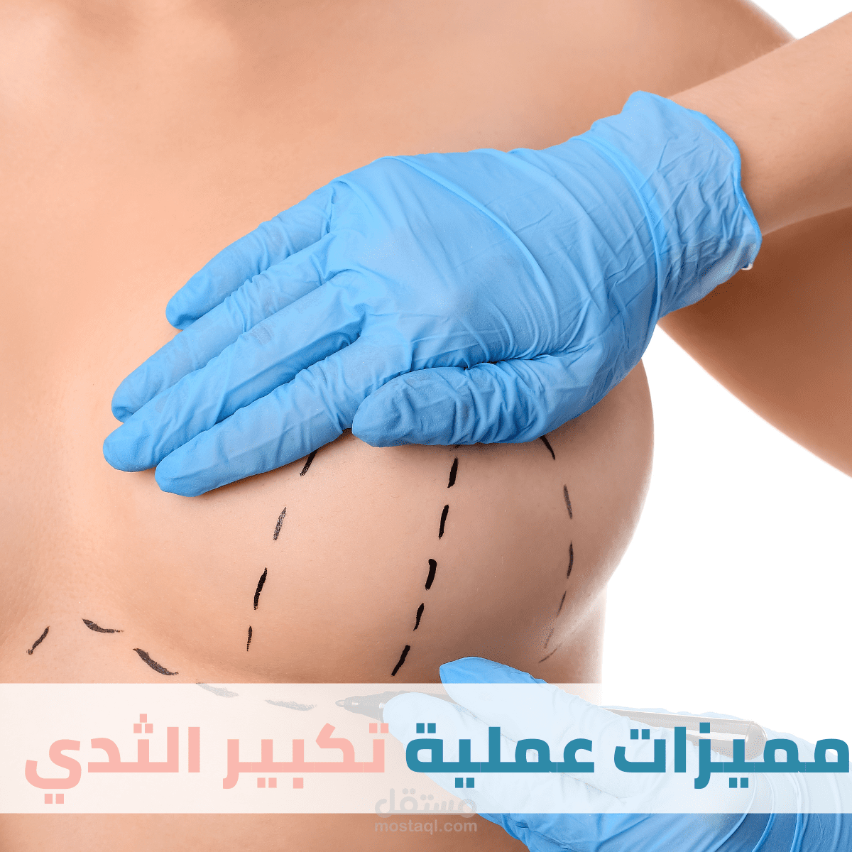 مقالة تحت عنوان:- "مميزات عملية تكبير الثدي" لموقع شخصي لدكتورة تجميل