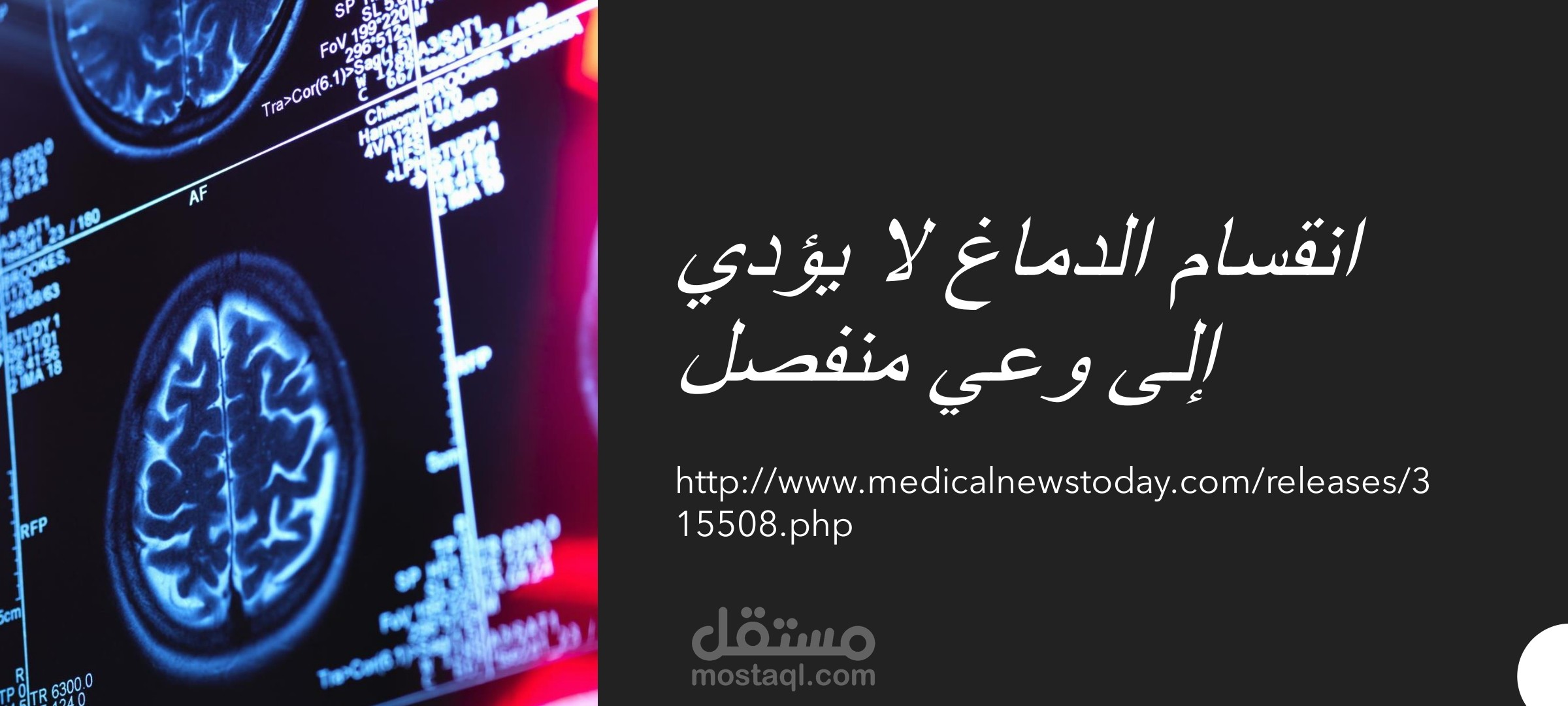 ترجمة مقال علمي في علم الأعصاب