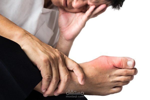 مقال طبي (ماذا تعرف عن النقرس؟) داء الملوك