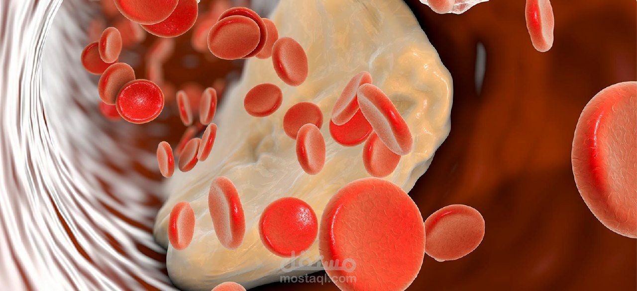 ترجمة طبية ضمن موضوع فقر الدم