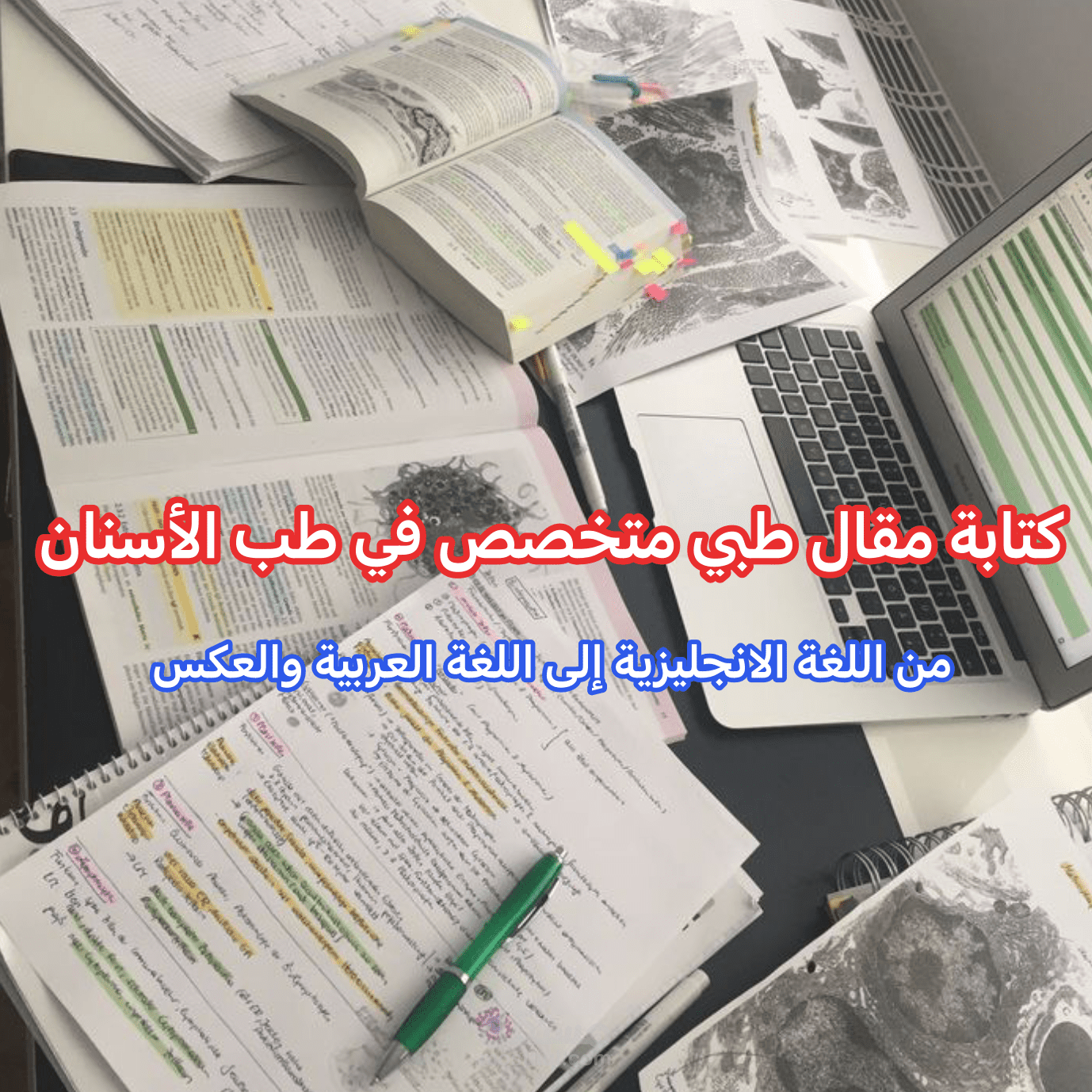 كتابة مقالة بعنوان ( رائحة الفم الكريهة ).