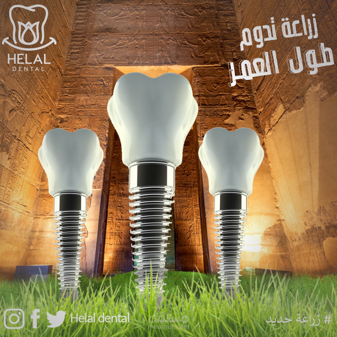 بوست سوشيال ميديا لمركز زراعة اسنان
