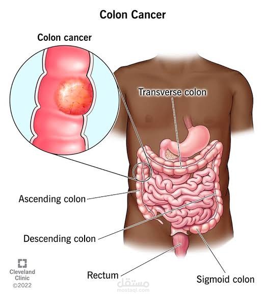 Medical article