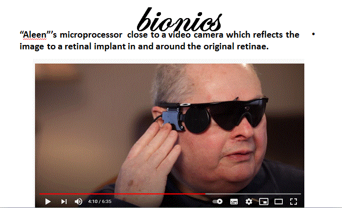 العين الصناعية:  حقيقة أم خيال؟