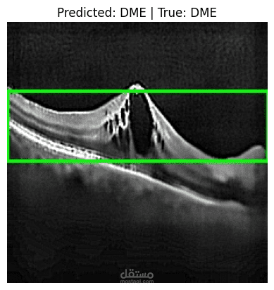 Retinal OCT Disease Classification
