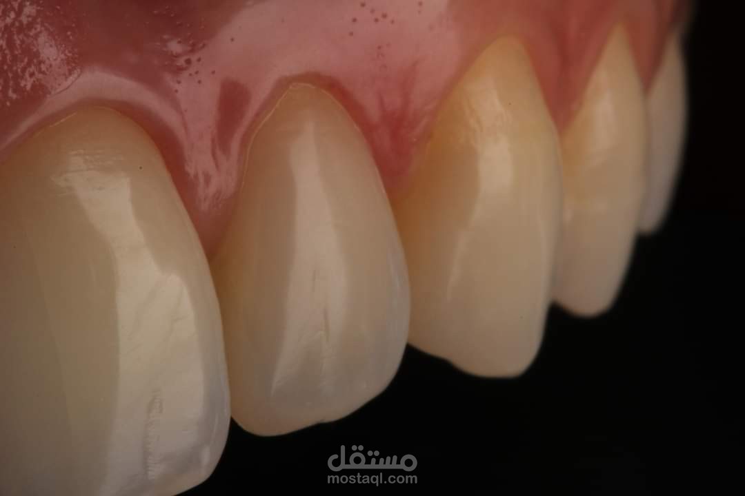 Dental motion graphic designs