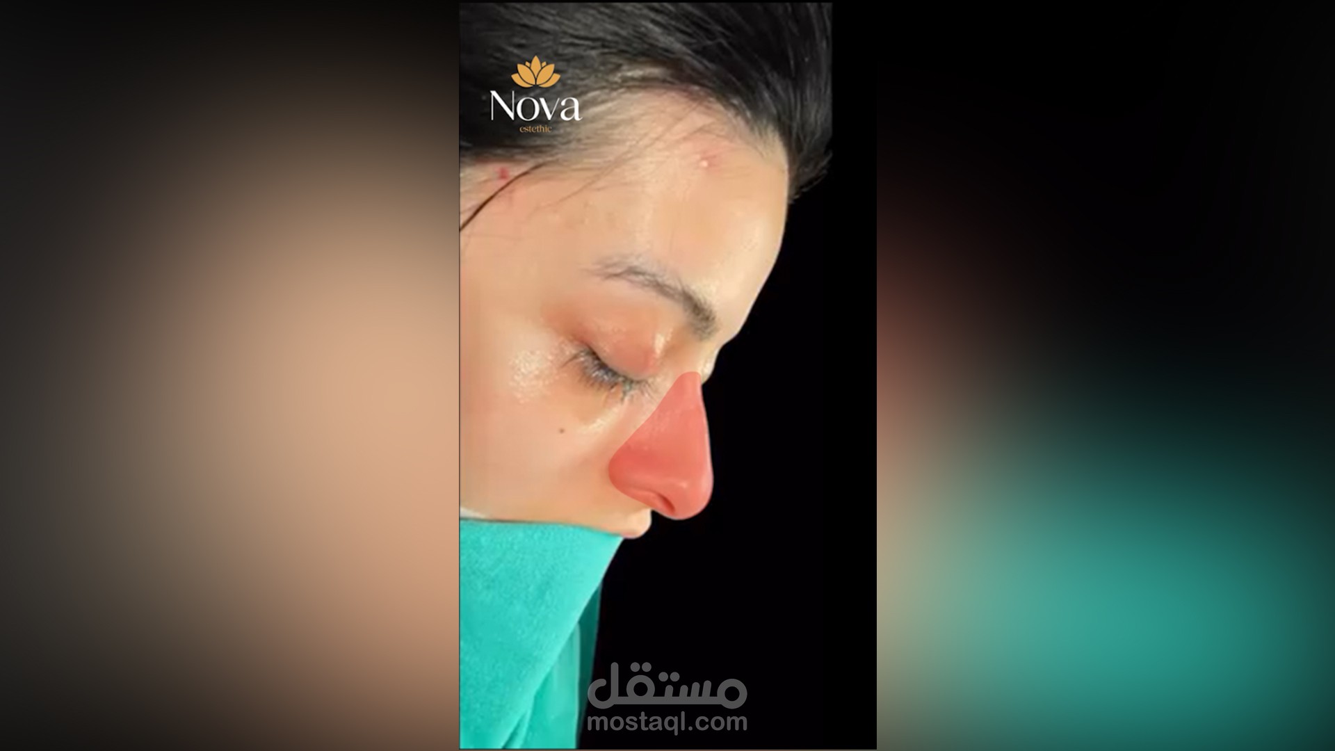 فيديو لمركز عملايت تجميل