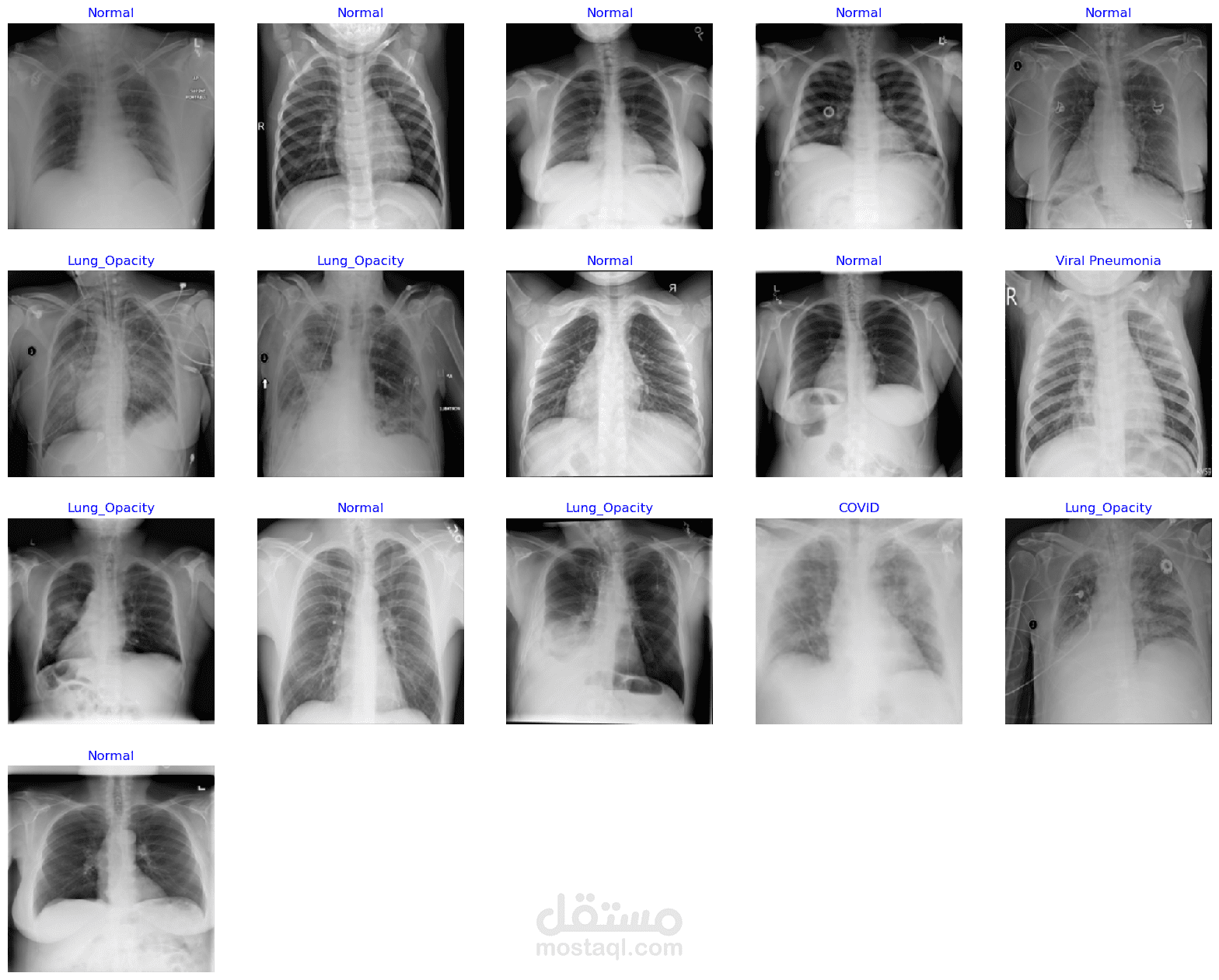Covid-19 Radiology