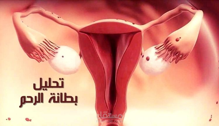 مقال عن: تحليل بطانة الرحم