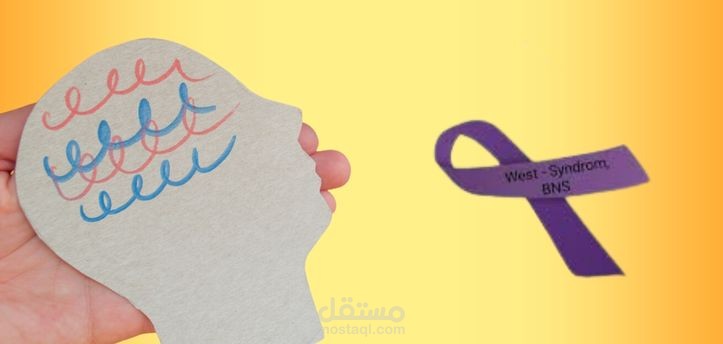 مقال عن: متلازمة ويست