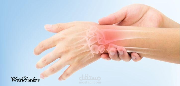 مقال عن: كسر الرسغ