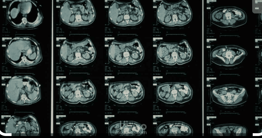 COVID-19 classification