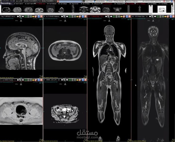 برنامج ذكاء صناعي للاجهزه الطبيه