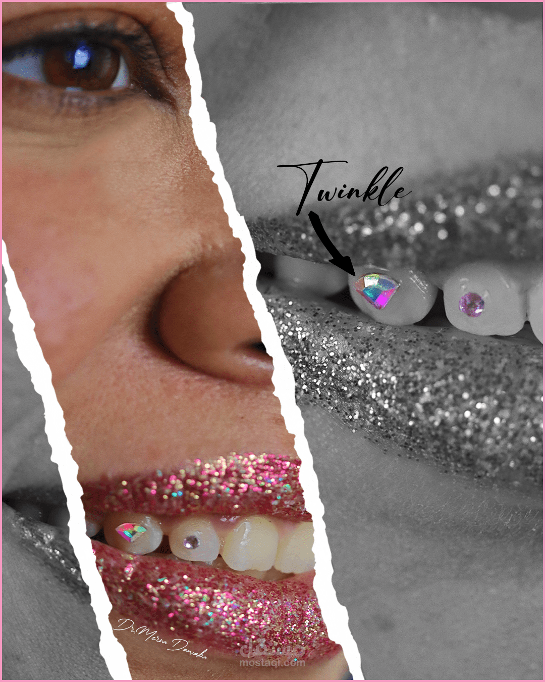 (Social media ( tooth Twinkle