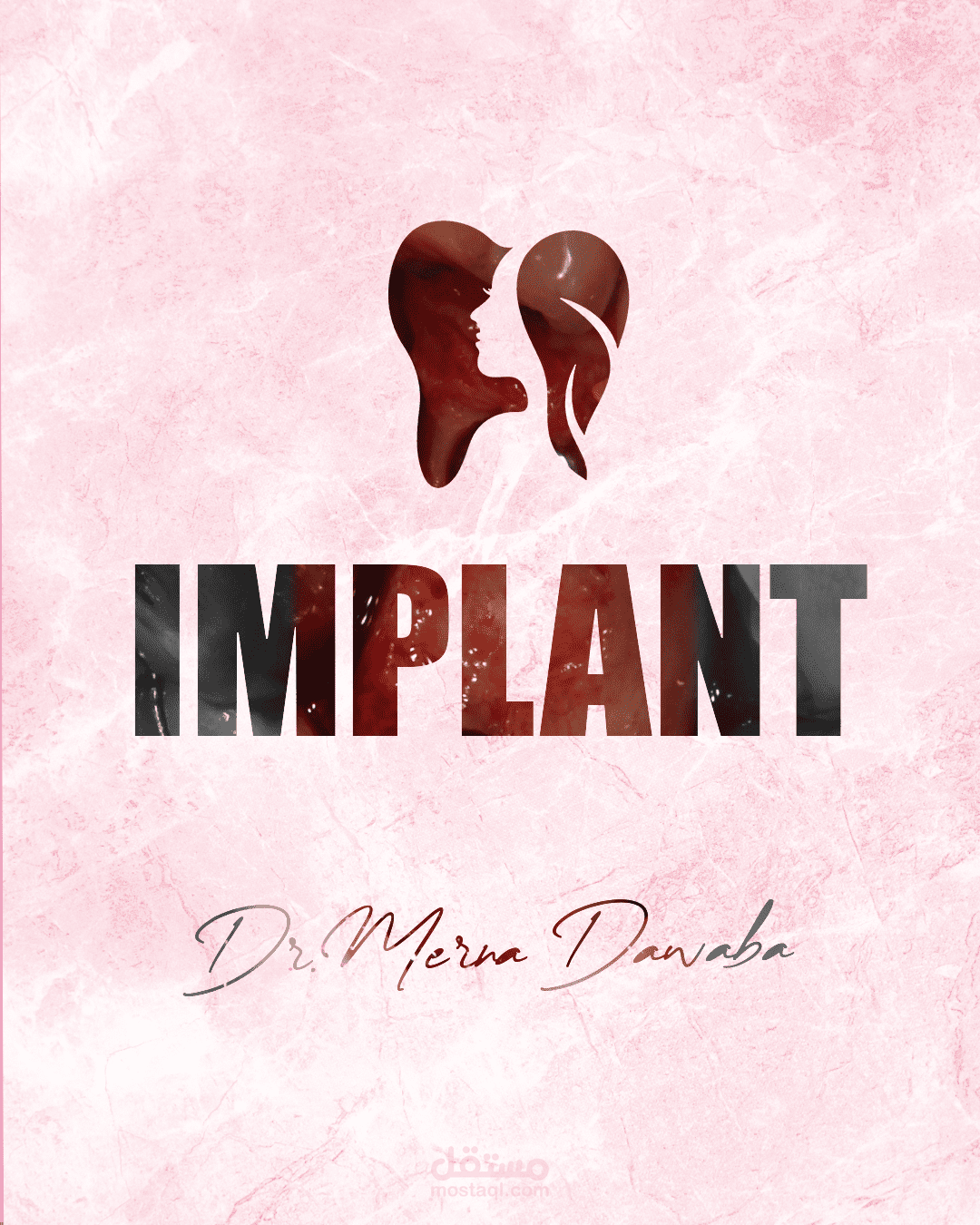 تصميم لصالح عيادة اسنان عن خطوات زراعة الاسنان