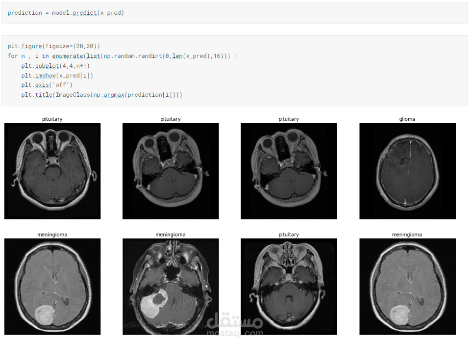 brain_tumor classification