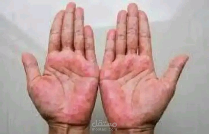 تفريغ صوتي