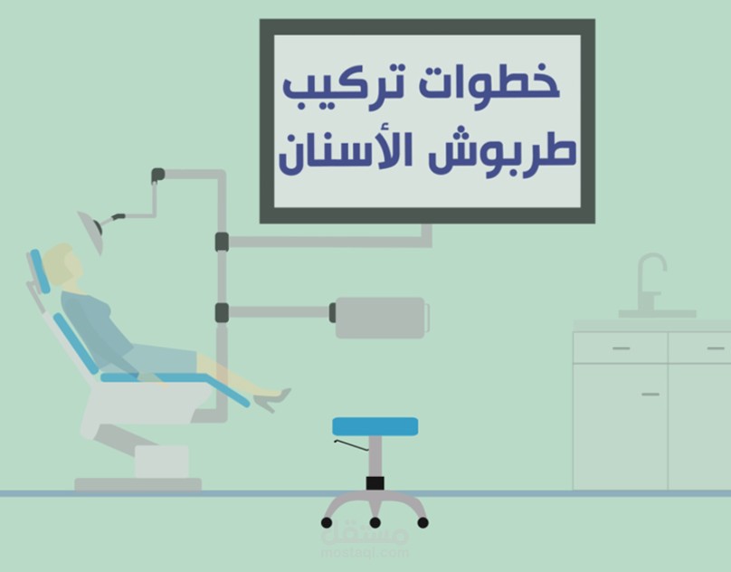 موشن جرافيك - خطوات تركيب طربوش الأسنان