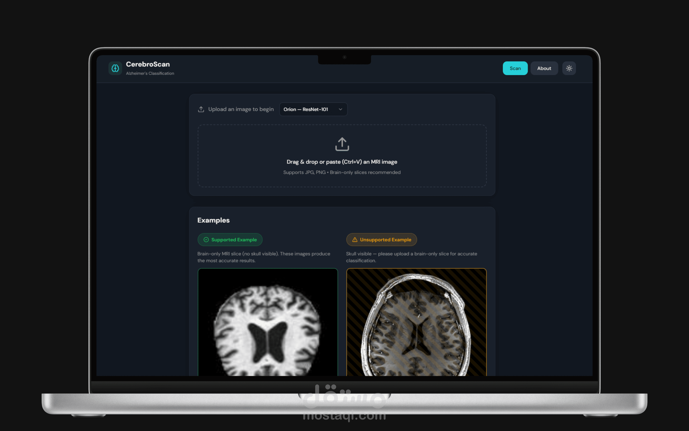 CerebroScan | تطبيق ويب بالذكاء الاصطناعي للكشف عن مراحل ألزهايمر
