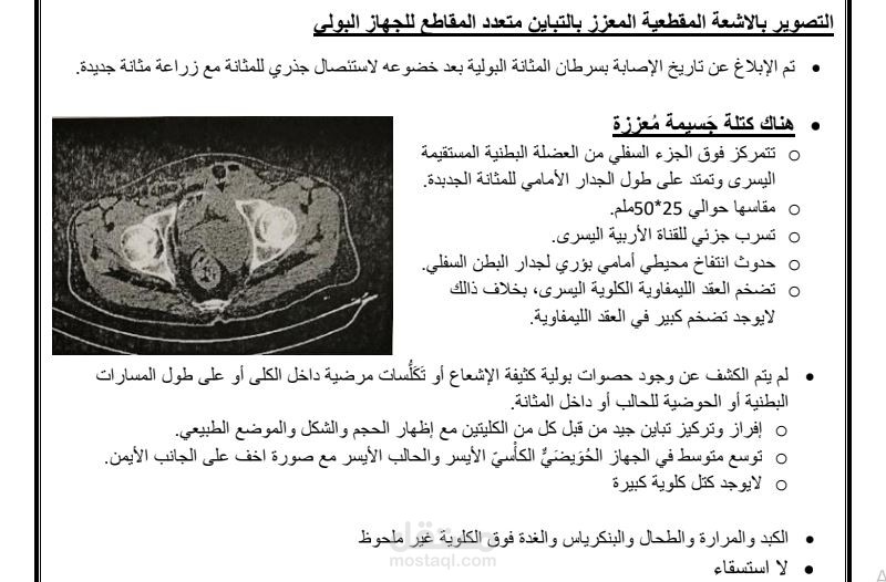 ترجمة لتقرير أشعة مقطعية على الجهاز البولي من الإنجليزية إلى العربية