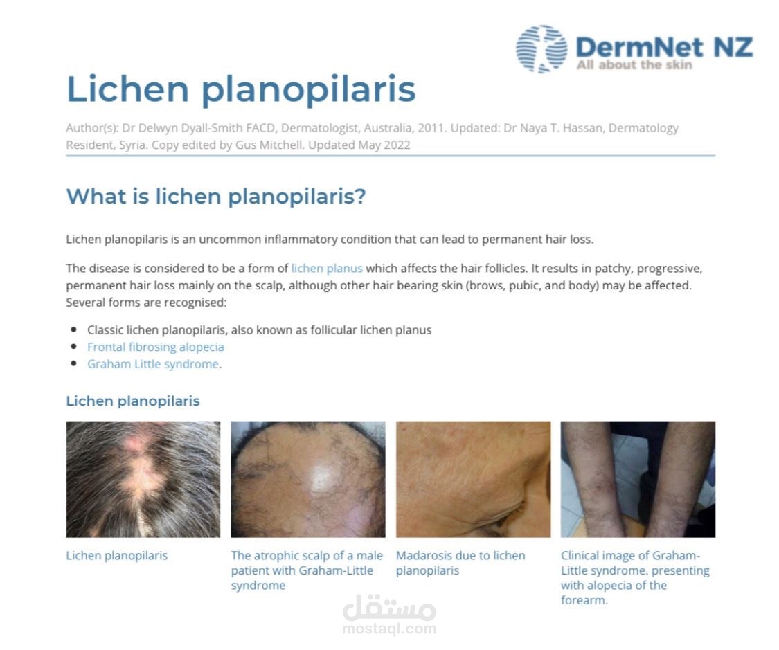 بحث علمي: الحزاز المسطح الشعري