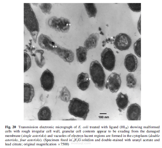 Synthesis, characterization, antimicrobial activity and ultrastructure of the affected bacteria of new quinoline compounds