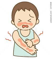 Medical Article : Penicillin allergy, Symptoms and treatment